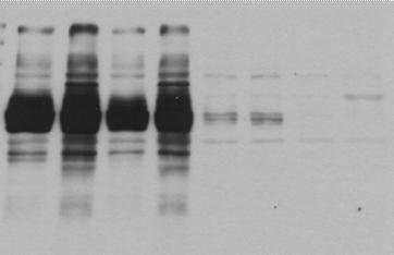 A kda 15 1 75 5 37 Dasatinib 1 nm 1 nm 1 µm IC IC IC IC PY B Syk IP 1 nm dasatinib IC IC PY Syk 25 foszfo-p38 p38 foszfo-syk Syk 26.