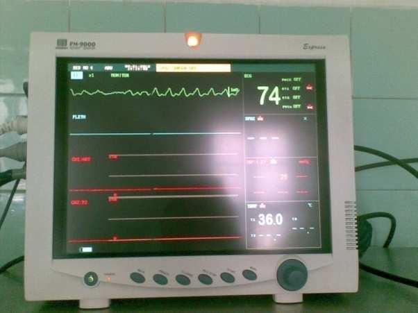 Ritmusdiagnosztika II. Van-e elektromos aktivitás?