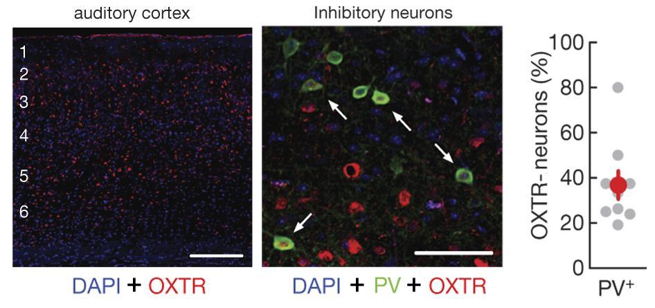 OXYTOCIN RECEPTOROK A HALLÓKÉREGBEN Martin et al.