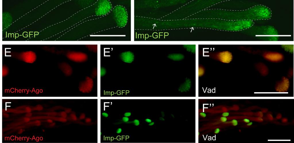 (A B α-spektrin, A B Imp-GFP, A, B összevetített) Az ago ms mutánsban a Spektrin vad típusú szerveződést mutat.