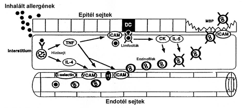 1.ábra A gyulladás patomechanizmusa asztmában Az eozinofil sejtek először a légúti keringés vaszkuláris endotél sejtjeihez kötődnek adhéziós molekulák közvetítésével, majd a szubmukozába kerülnek és