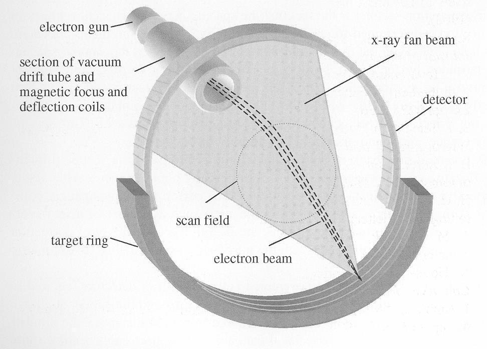 5G Electron Beam Scanner - 1979 Differing design avoids motion Electron beam (EB) steered by magnetic field Hits