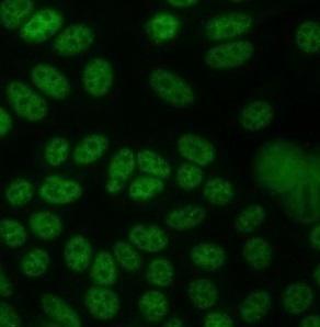 immunfluoreszcens