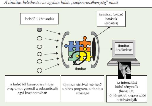 A tinnitus keletkezése az agyban hibás