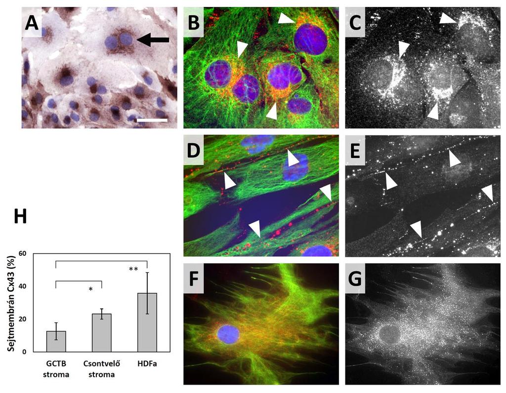 26. ábra. A Cx43 fehérje kifejeződése és sejten belüli lokalizációja óriássejtes csonttumor (GCTB) és csontvelői stromasejt tenyészetekben, illetve HDFa sejtvonalban.