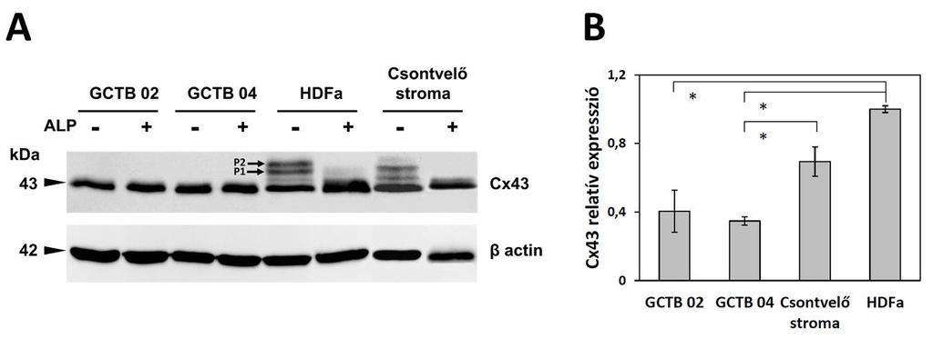 28. ábra. A Cx43 fehérje Western blottal történő detektálása óriássejtes csonttumor (GCTB) és csontvelői stromasejt tenyészetekben, illetve HDFa sejtvonalban.