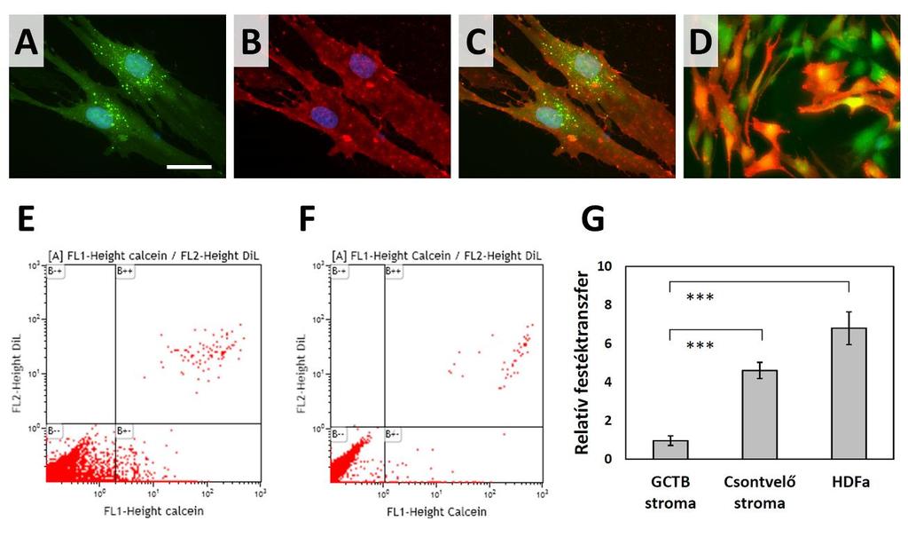 29. ábra. Festéktranszfer és a sejtek közötti kommunikáció meghatározása áramlásos citometriával óriássejtes csonttumor (GCTB) és csontvelői stromasejt tenyészetekben, illetve HDFa sejtvonalban.