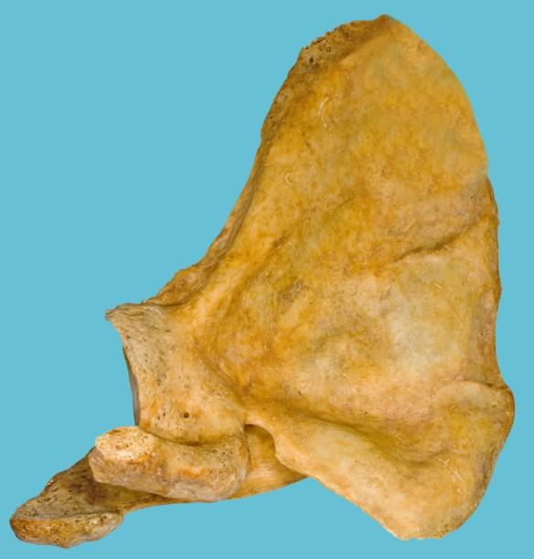 glenoidalis Angulus lateralis Fossa subscapularis L Incisura