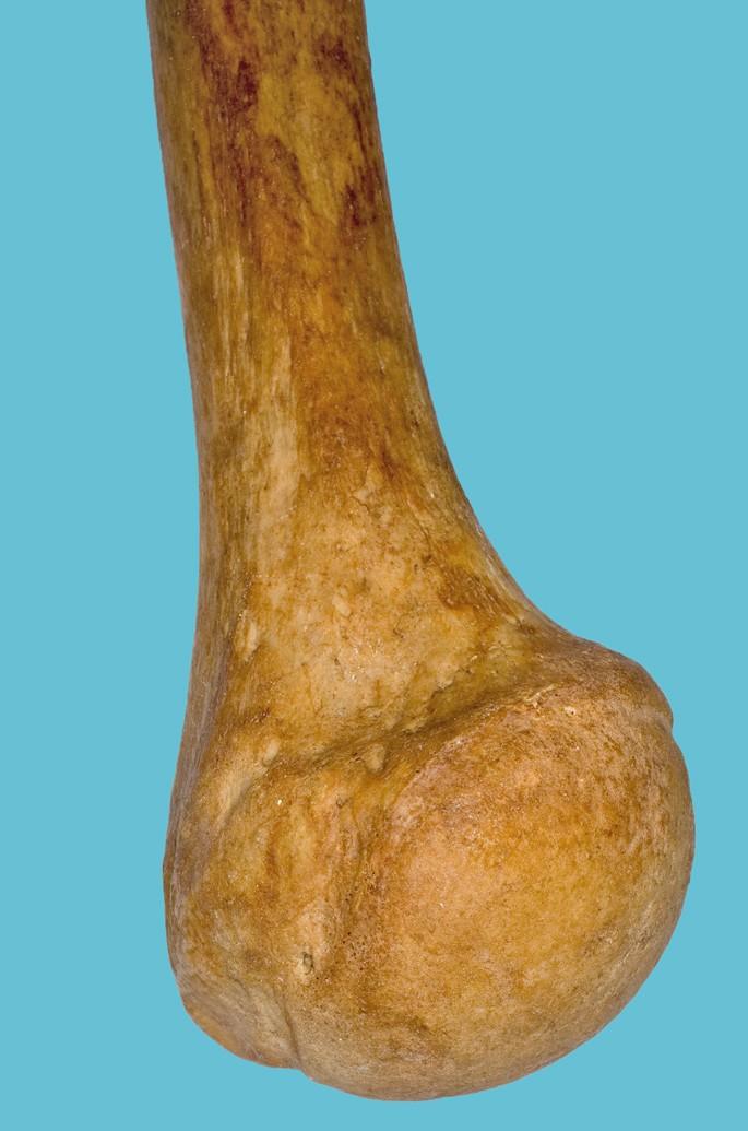 tuberculi minoris Tuberculum majus L L Crista tuberculi majoris