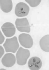 hu Babesia Kutya: Babesia canis 4-7 µm Babesia gibsoni