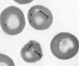 Mycoplasma nevezéktan További fontos Babesia fajok Ló: Babesia caballi Theileria equi Szarvasmarha: Babesia bigemina Babesia bovis Régi nevén: Haemobartonella felis Mycoplasma haemofelis (Mhf),