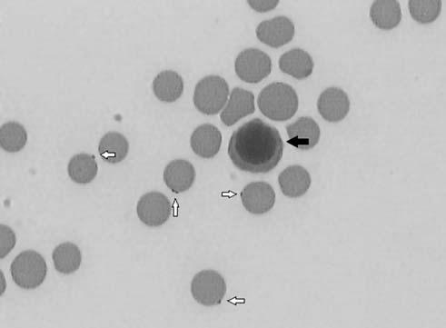 Enrofloxacin 5 mg / ttkg/nap ) IHA