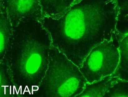 arra engedett következtetni, hogy a TIMAP fehérjének fontos szerepe lehet a TGF- 1 által okozott változások helyreállításában, mint például apoptózis vagy barrier diszfunkció.