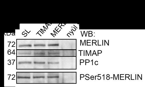 7.10. ábra. A merlin és a PP1c-TIMAP komplex kölcsönhatásának detektálása endotél sejtekben.