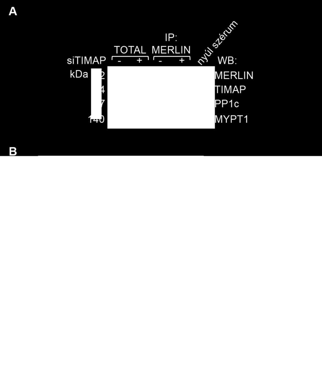 A csendesített és nem-specifikus sirns-sel kezelt sejtek totál lizátuma és immunprecipitátuma Western blot kísérletben lett vizsgálva specifikus merlin, TIMAP, PP1c és MYPT1 elleni antitestekkel.