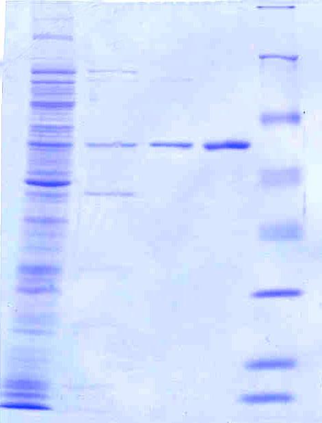 1 2 3 4 5 kda 116 66 45 35 25 18 9. ábra: A Leu214Ser+Tyr229H mutációkat tartalmazó SinI metiltranszferáz enzim tisztítása 1.