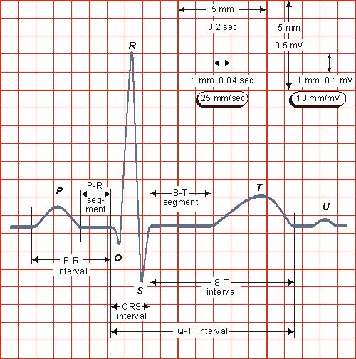 The last to depolarize are basal regions of both left and right ventricles. Because there is no longer a propagating activation front, there is no signal either.