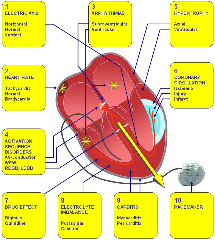 AZ EKG KLINIKAI JELENTŐSÉGE A sinus rhythm
