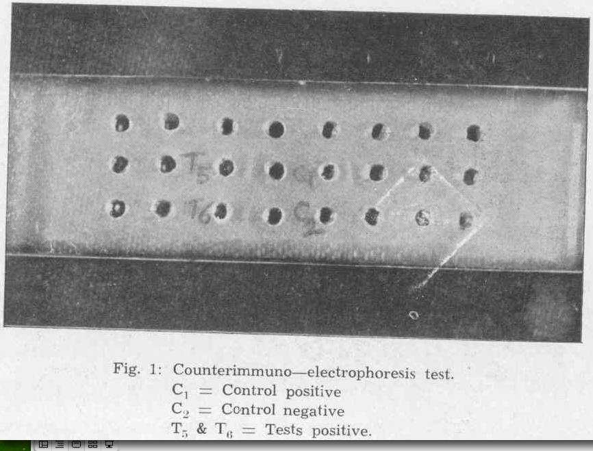 Counterimmuno-elektroforézis KÉTDIMENZIÓS IMMUNELEKTROFORÉZIS (CRIE) At + - minta A gélben egymással szemben vándorol az antigén és az antitest. Ha találkoznak precipitátum képződik.