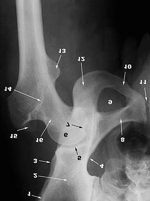 A CSÍP ÍZÜLET AP RTG-FELVÉTELEN 1. Spina iliaca ant. sup. 2. Os ilium 3. Spina iliaca ant. inf. 4. Linea arcuata 5. Fossa acetabuli 6. Caput femoris 7. Fovea capitis femoris 8.