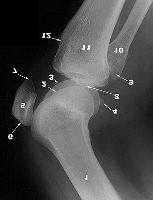 A TÉRDÍZÜLET LATERALIS RTG- FELVÉTELEN 1. Femur 2. Condylus lateralis femoris 3. Condylus medialis femoris 4. Fabella* 5. Patella 6. Basis patellae 7. Apex patellae 8.