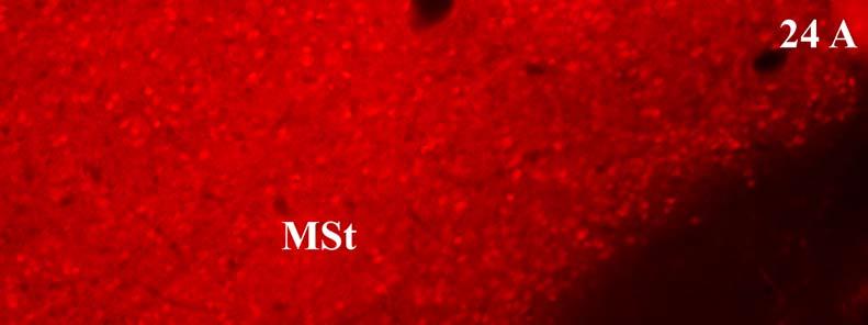 24. ábra Vörös szűrővel a DARPP-32+ sejtek piros