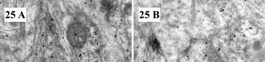 25. ábra Az elektronmikroszkópos felvételek a medialis striatumból