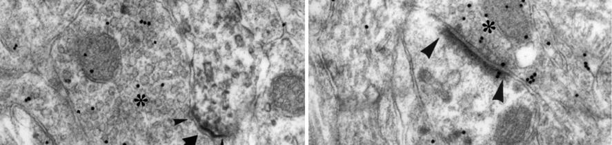 DARPP-32-immuncitokémiát követően.