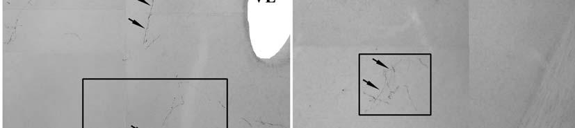 27. ábra A felvételek a nucleus tractus solitarii (NTS)-ből kiinduló anterográd pályakövetés eredményeit mutatják.
