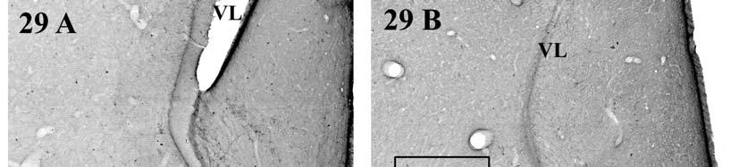 29. ábra A metszetek házicsirke ventrobasalis telencephalonjából, NPY-