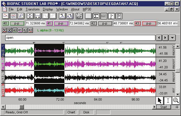 Electroencefalografia 59 Figura 33. Rezultatul înregistrării EEG biemisferial. 22. Selectaţi canalele de calcul (40-43, vezi şi Tabelul 4).