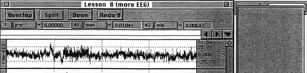 Electroencefalografia 57 comenzile din Tabelul 3. În momentul fiecărei comenzi se apasă şi tasta F9 pentru a marca momentul. Concomitent se bifează în tabel comanda executată.