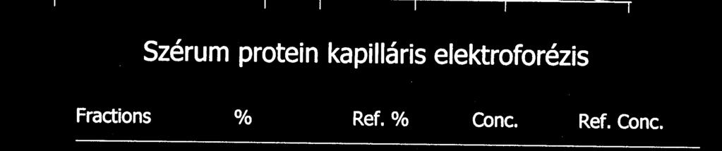 Gamma frakció monoclonalis komponens