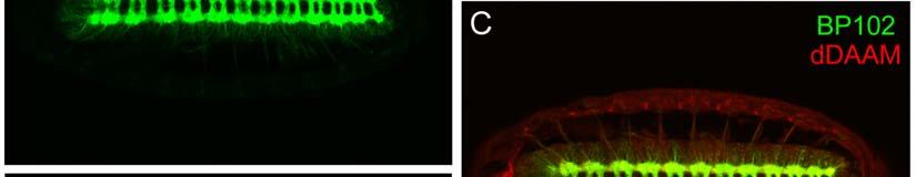 13. ábra A ddaam fehérje lokalizációja az embrionális központi idegrendszer területén.