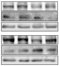 Hasonlóan a SERCA2a mrns és protein szintjéhez a szívek PLB mrns és protein szintje alacsonyabb volt a 3 hónapos MLP-KO egerekben, mint a kontrollokban.