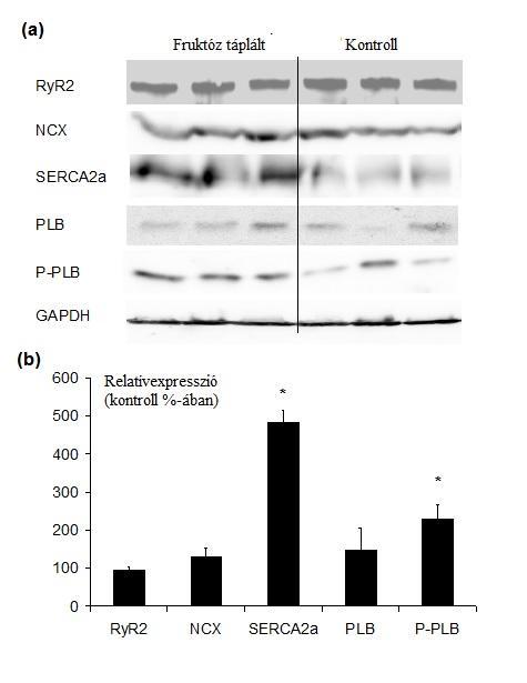 13. Ábra A fruktóz táplált és a kontroll állatok szívéből vett mintán készített Western blot analízis során készül reprezentatív képeket láthatjuk, amelyeken a RyR2, NCX, SERCA2a, PLB, P-PLB és GAPDH