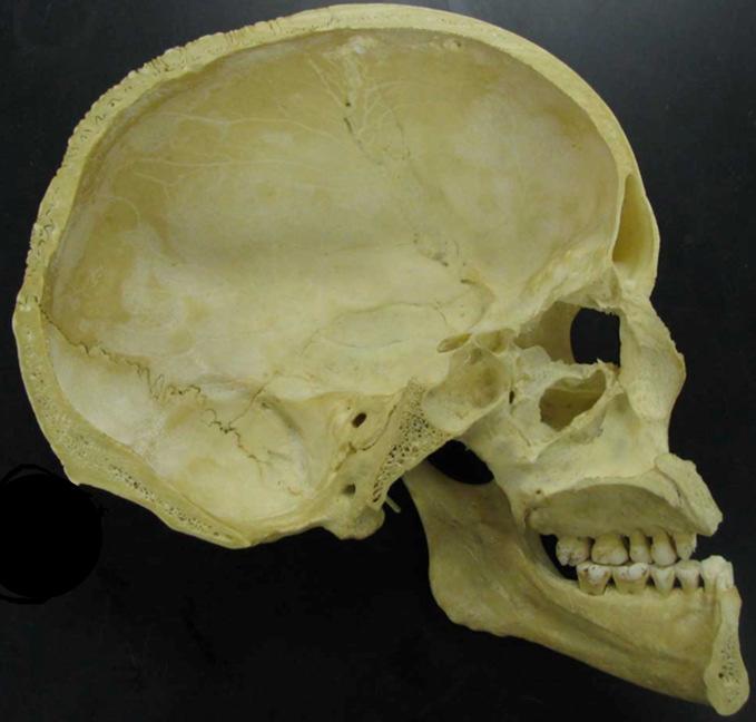 CAVUM ORIS (szájüreg) Palatum osseum M m.