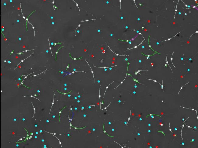 A piros színnel jelölt sejtek immotilisak (nem mozognak), a zöld sejtek progresszíven mozognak (a jelölt vonal mentén), a sötétkék sejtek