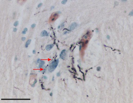 8. ábra: Az agytörzs keresztmetszeti képe a nucleus nervi oculomotorii szintjében.