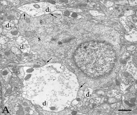 dendriteken végződött axonterminálisok egy része kerek, más része lapos vesiculákat tartalmazott. A neuropil területén számos, egymáshoz közel elhelyezkedő dendritet lehetett megfigyelni.