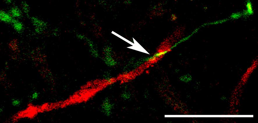 41. ábra: Konfokális mikroszkópos felvételek szoros appozíciókról. Kalibrációs vonal: 1 µm. 5.2.2. A n.