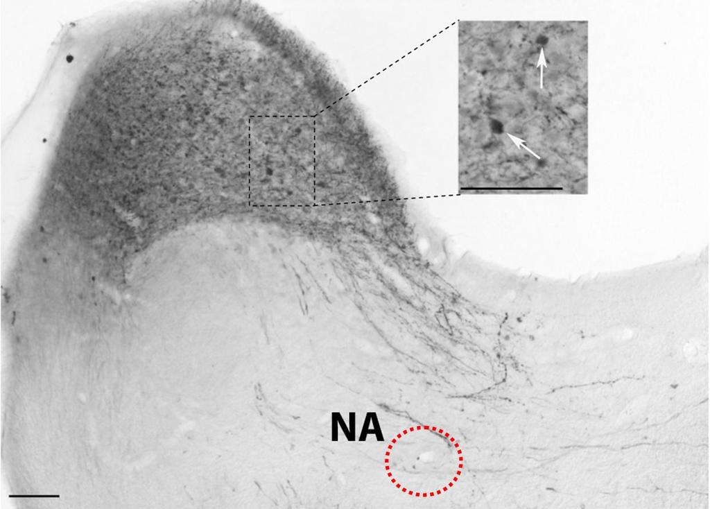 42. ábra: Neurobiotin jelölt vestibulocochlearis rostok az agytörzs keresztmetszetben. Az inzerten a jelölt terminálisok és a dye-coupled másodlagos vestibularis neuronok láthatók.