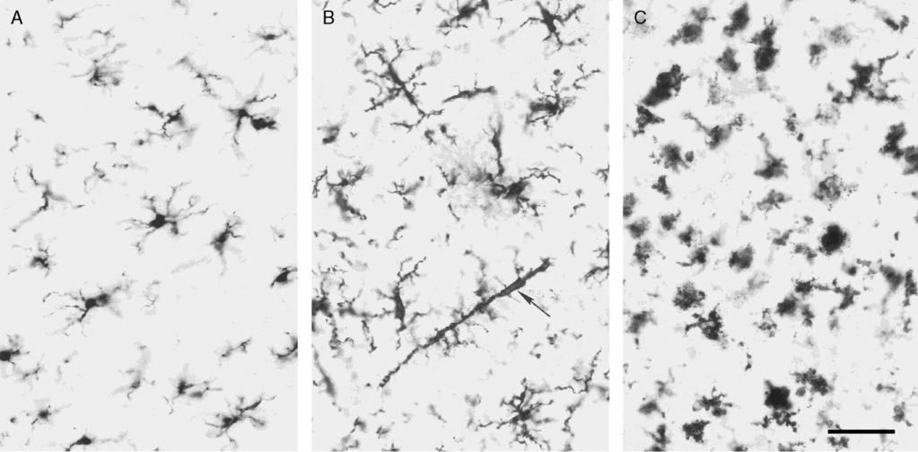 A mikroglia általános jellemzői CNS szöveti makrofágok - nem ektodermális!