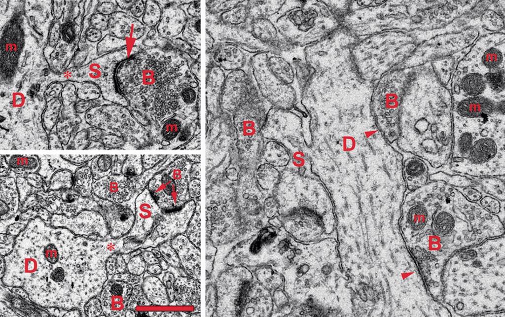 morfológia jellemzők dendritic spines (S) narrow spine necks (asterisks) dendritic shaft (D) spine apparatus particularly visible in the lower panel spine postsynaptic