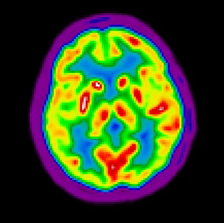 Kisállat leképzésre alkalmas PET-MRI (Caltech USA,