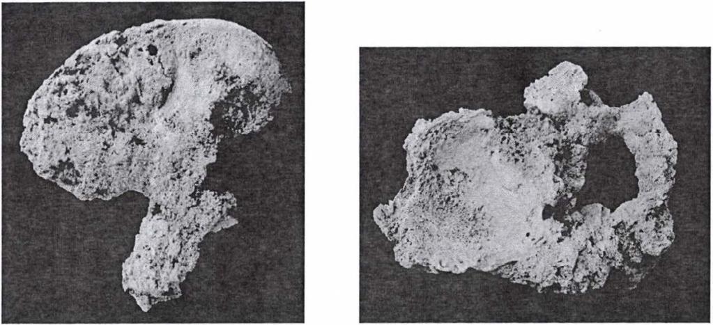 Eredmények Makroszkópos morfológiai megfigyelések A destrukciók az alsó végtag és az alkar csontjai kivételével csaknem az egész csontvázat érintik.