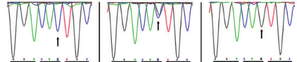 28 29 126 185 A 270 150 156 194 A 260 146 154 194 A 258 154 152 188 270 148 OLVADÁSPONT ANALÍZIS A DNS olvadásának nevezzük azt a jelenséget, amikor a DNS kettős spirálja hő hatására kicsavarodik, és