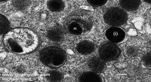 Elemi testek (endocytosis) Retikuláris test (korai)