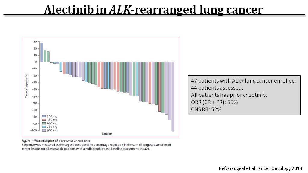 Alectinib hatékony megelőző crizotinib kezelés során kialakult
