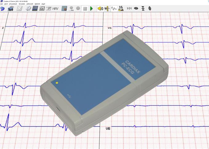 Cardiax számítógépes EKG